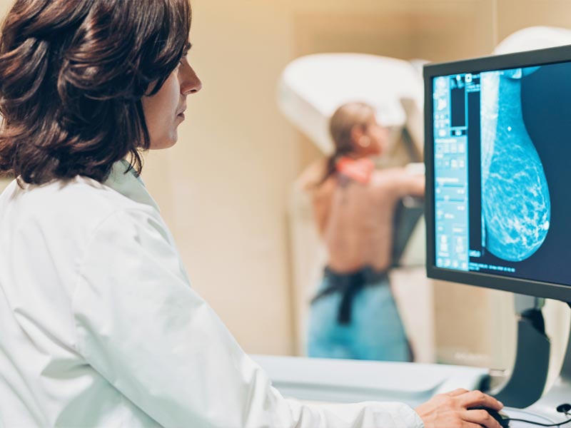 Μαστογραφία και άλλες Εξετάσεις Προσυμπτωματικού Ελέγχου για τα Προβλήματα του Μαστού - Mammography and Other Screening Tests for Breast Problems