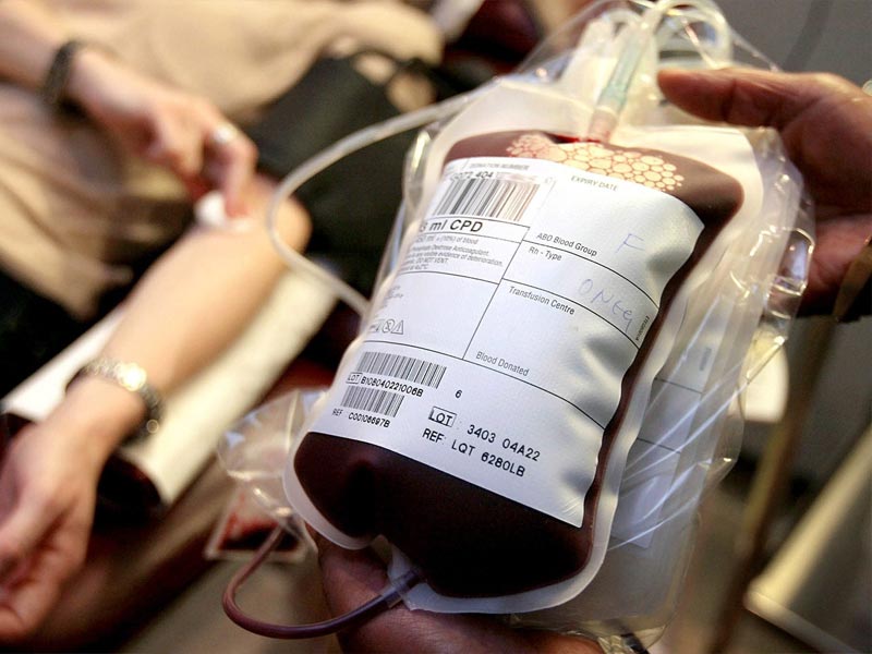 Διασταύρωση Αίματος για τον Επικείμενο Τοκετό - Blood Donation for Possible Transfusion After Labour