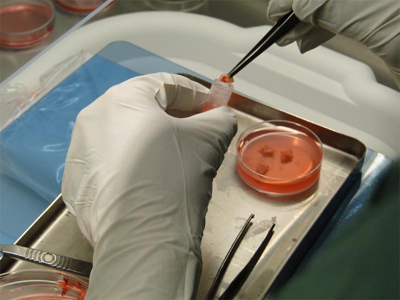 Κρυοσυντήρηση - Κατάψυξη Ωοθηκικού Ιστού - (Ovarian Tissue Cryopreservation)