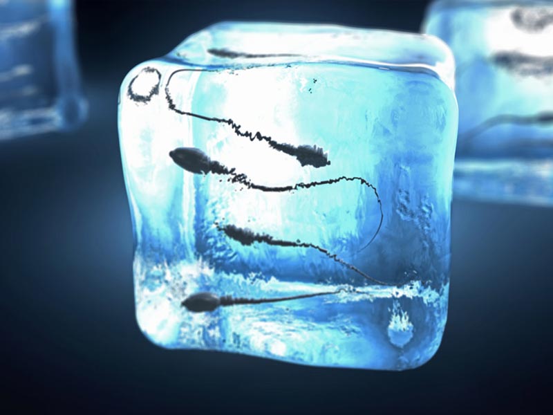 Κρυοσυντήρηση - Κατάψυξη Σπέρματος (Semen Cryopreservation - Sperm Banking or Sperm Freezing)
