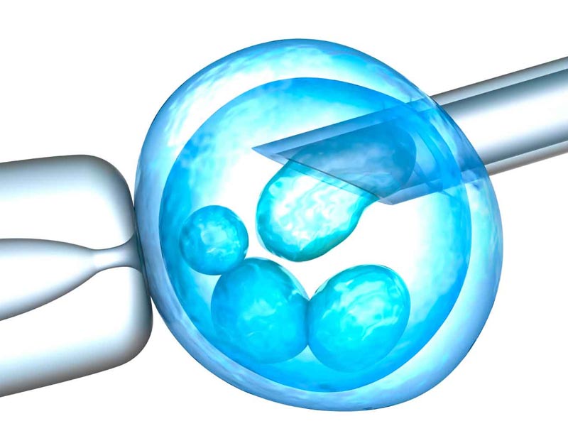 Εξωσωματική Γονιμοποίηση - IVF (IN VITRO FERTILIZATION)