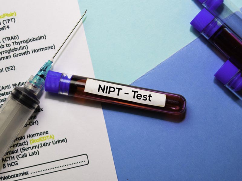 Μη Επεμβατικός Προγεννητικός Έλεγχος - Non-Invasive Prenatal Testing (NIPT)